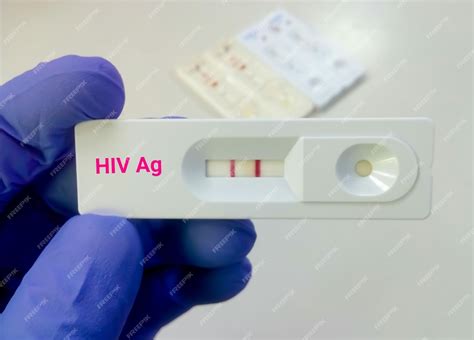 hiv positive results images|Hiv Positive Photos and Premium High Res Pictures .